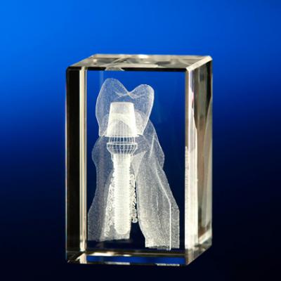 Molar mit Implantat parallel